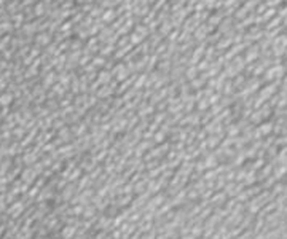 granulation